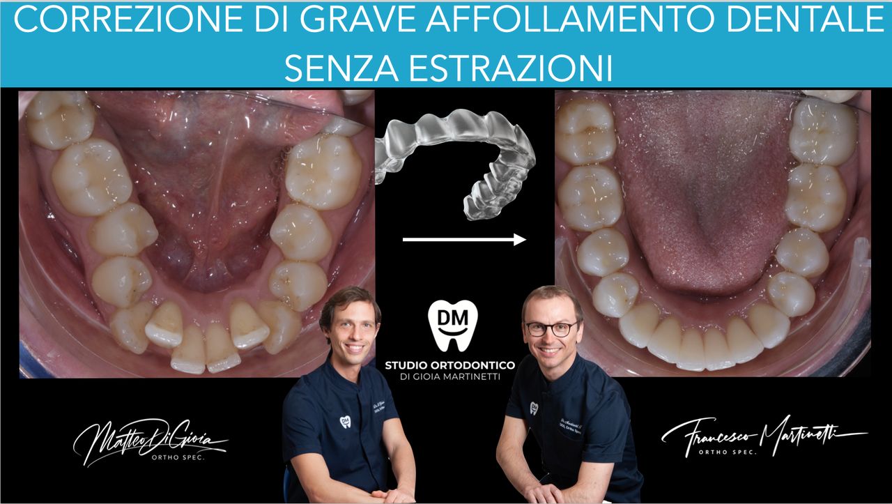 Francesco Martinetti-3