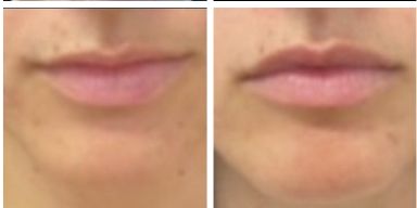 Silvia Melania Baio-18