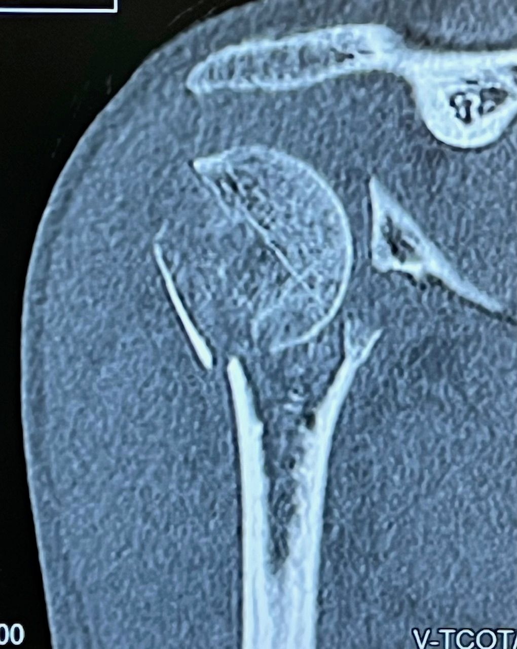 Manel Panadero Moncusi-11