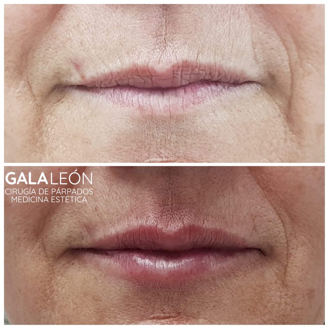 Gala P. Leon Salvatierra-23