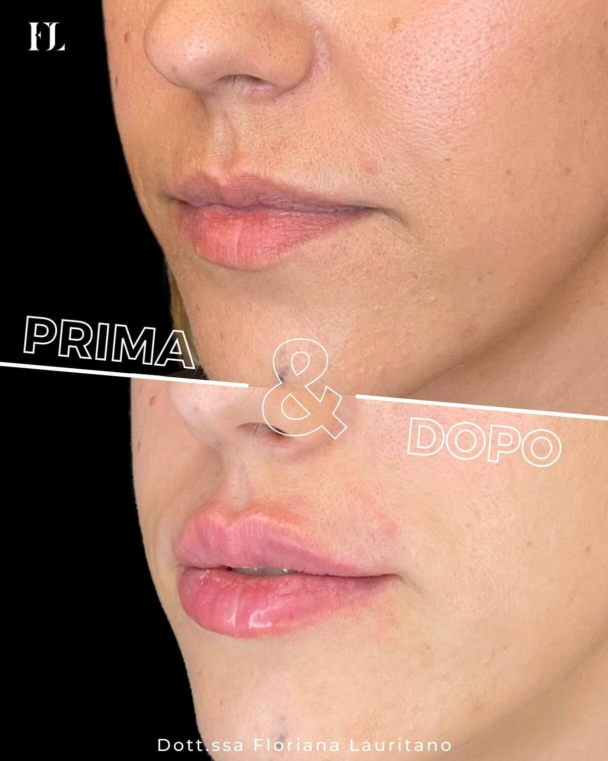 Floriana Lauritano-32