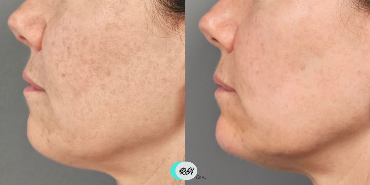 Rosalba Herrero Zerpa-613