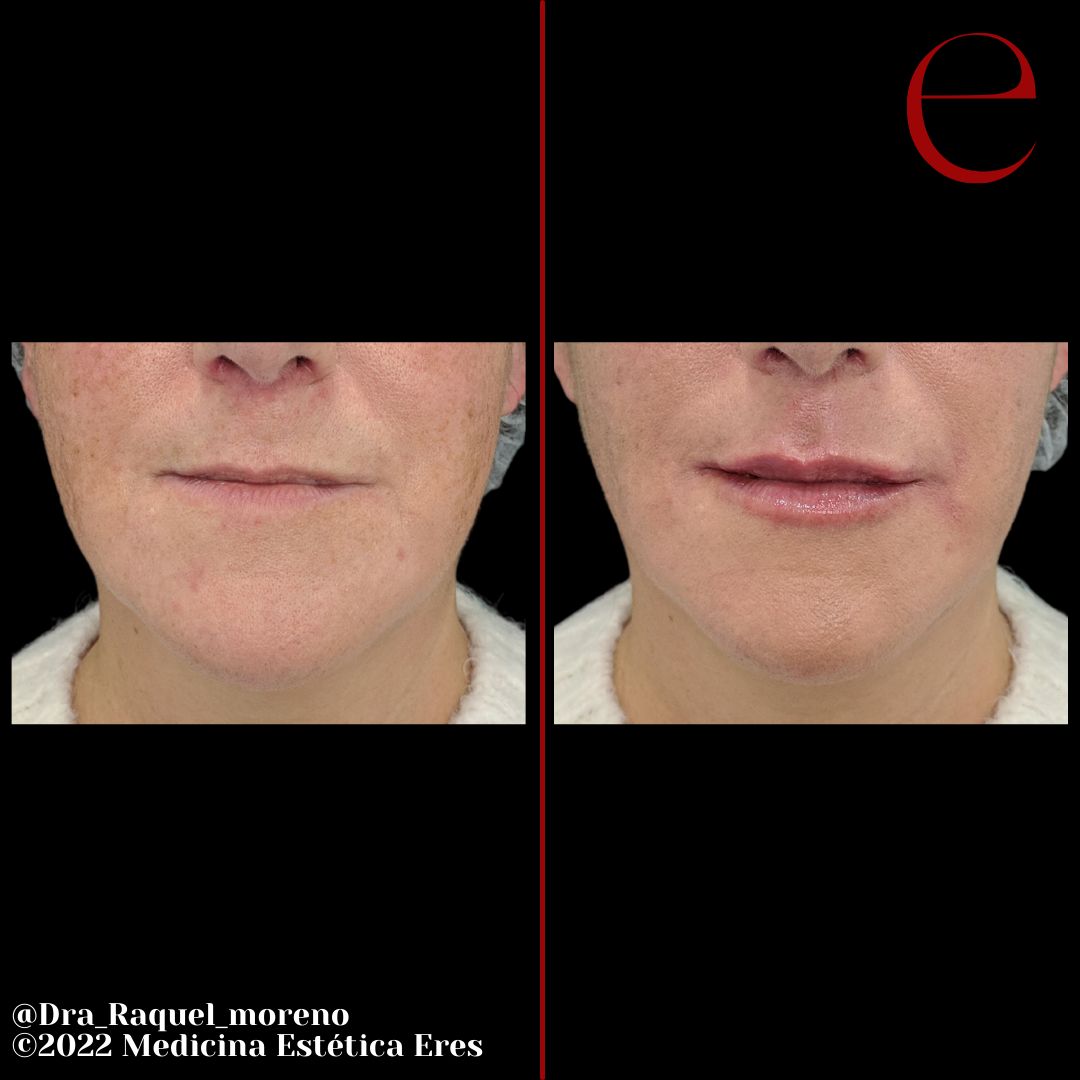 Raquel Moreno Pentinel-93