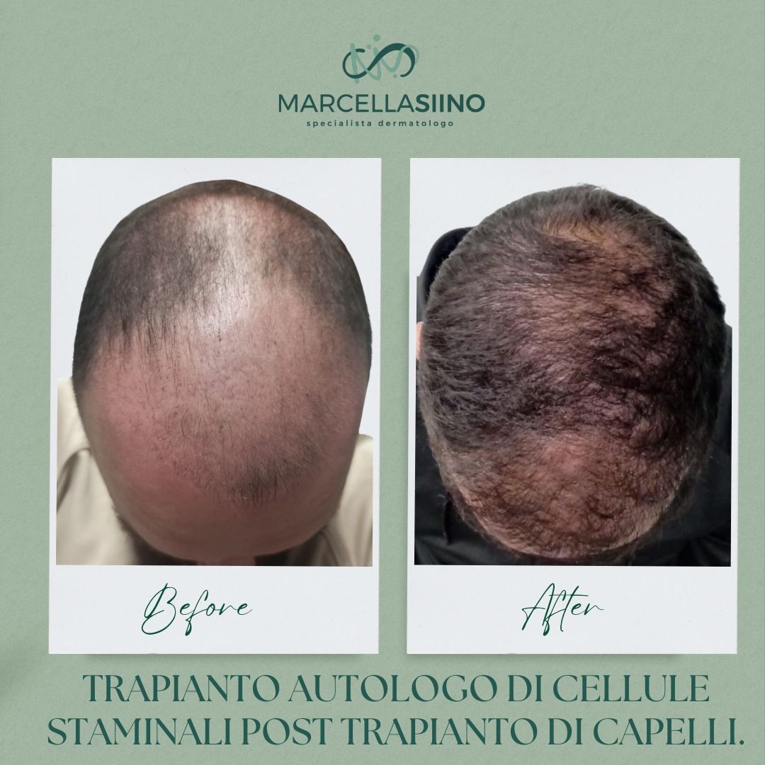 Marcella Siino-5