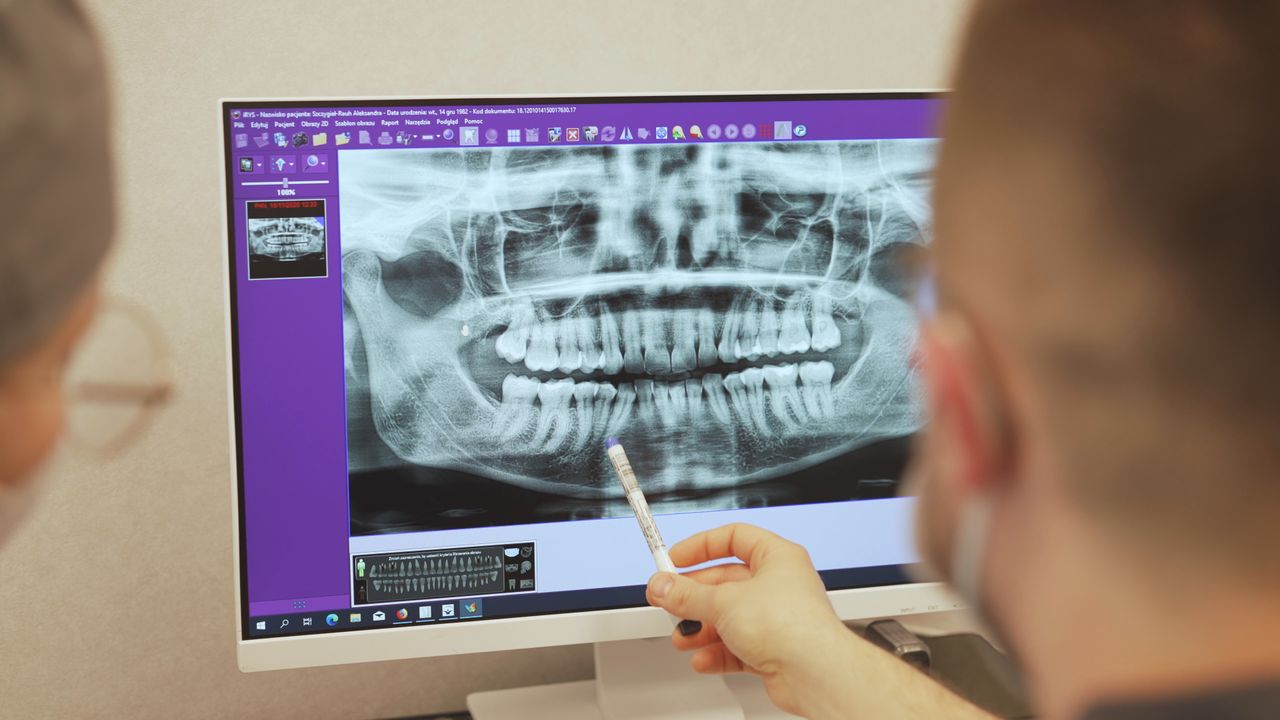 Tomograf Komputerowy Medicover Sosnowiec Małachowskiego-0
