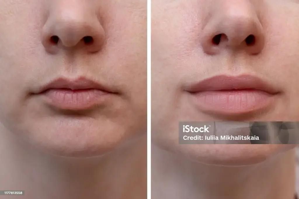 Stefania Martinelli-16