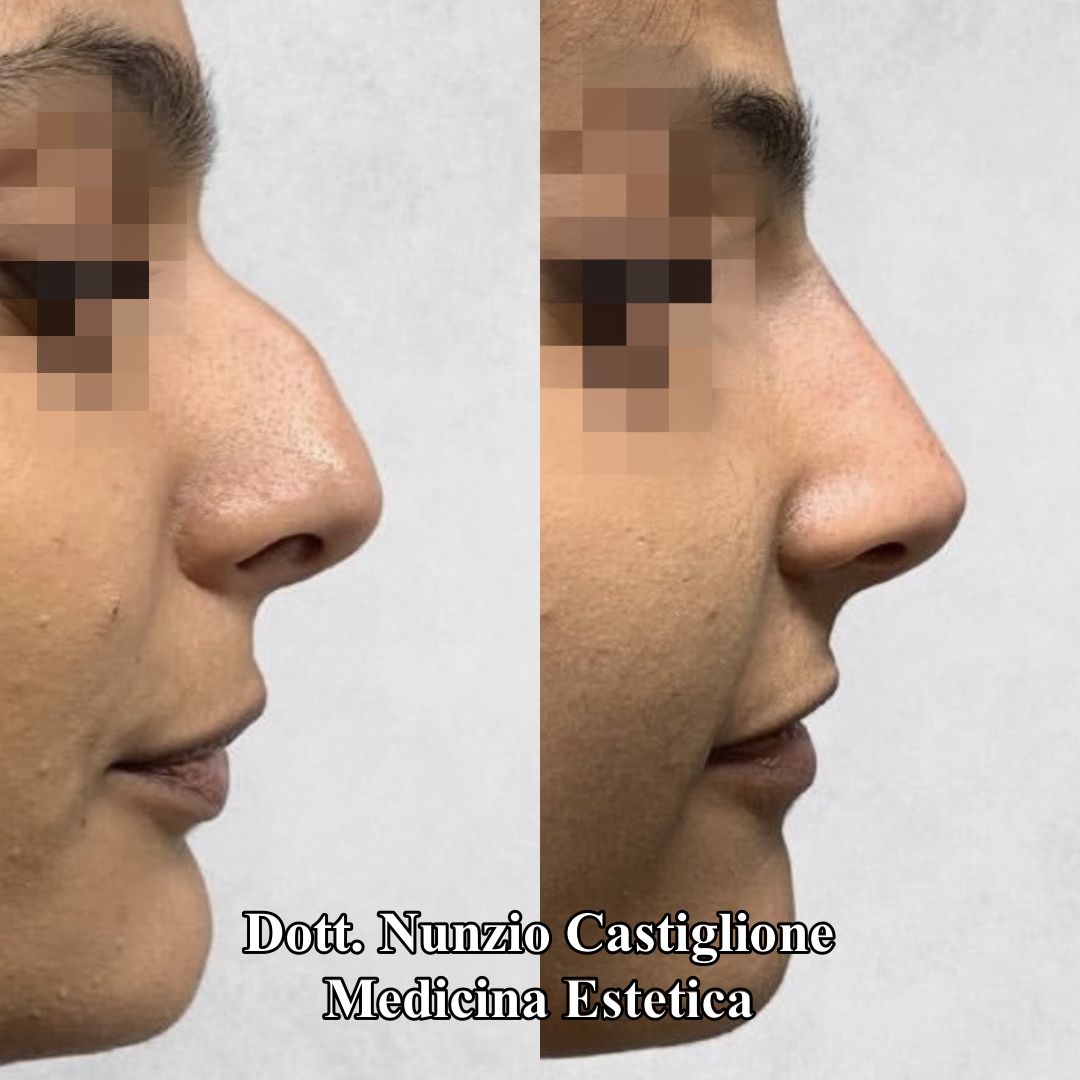 Nunzio Castiglione-4