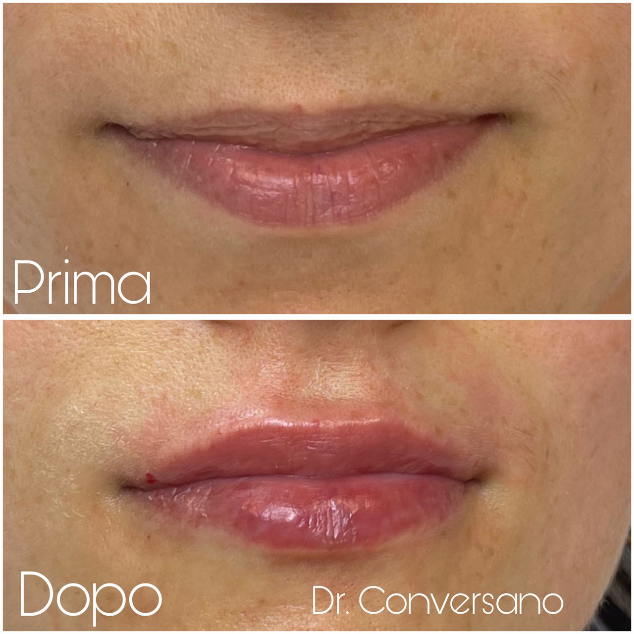 Sergio Conversano-22