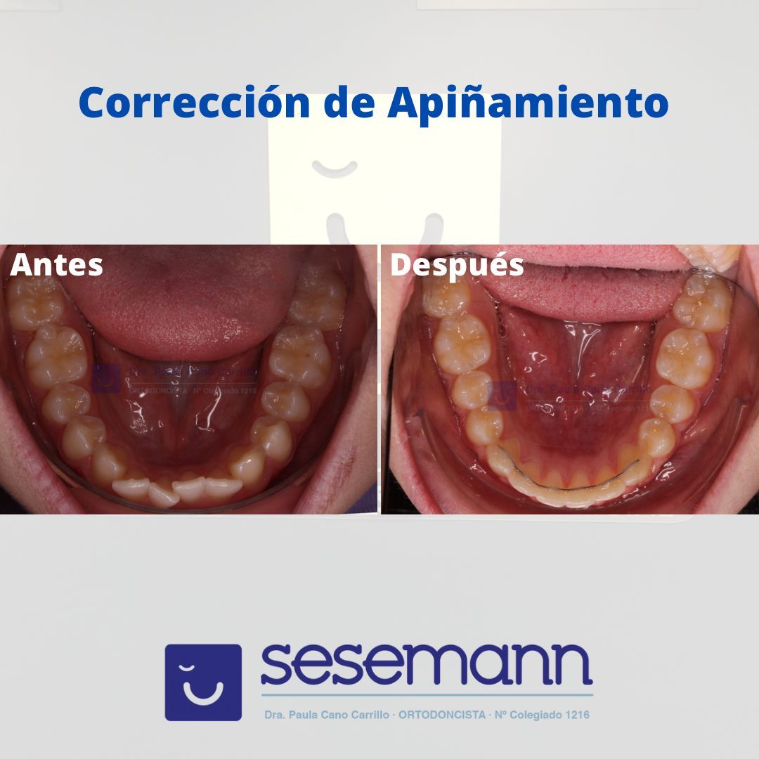 Paula Cano Carrillo-57