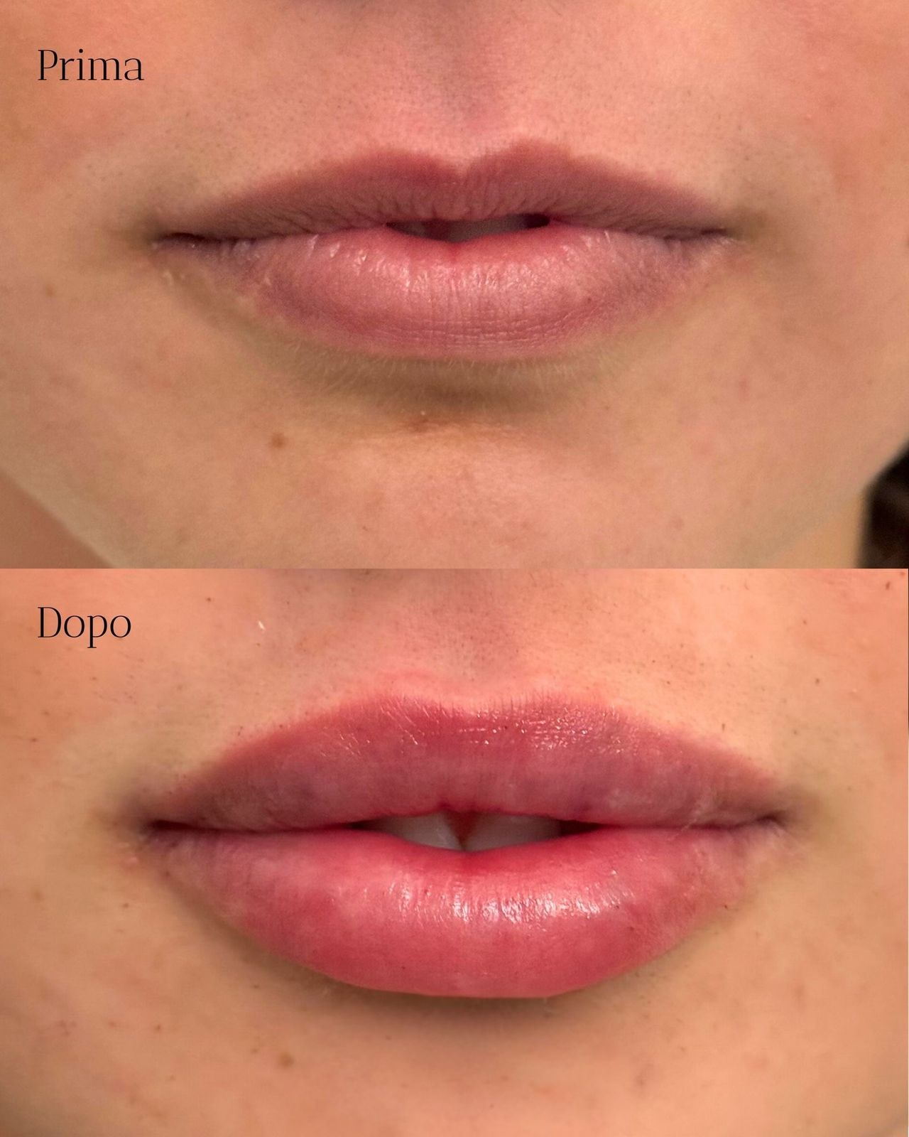 Pier Paolo Ferretti-6