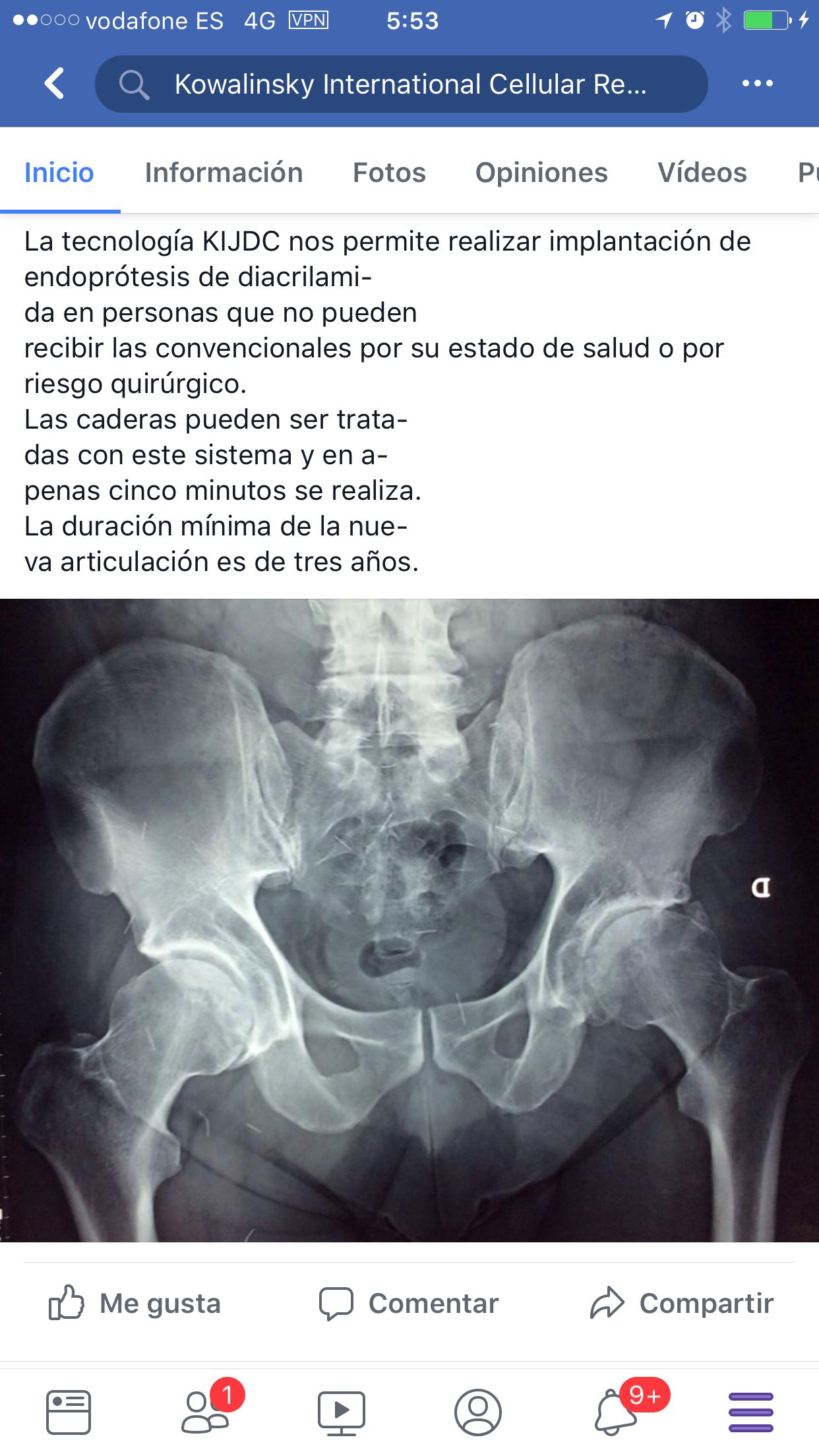 Juan Manuel Cowalinsky Millan-4