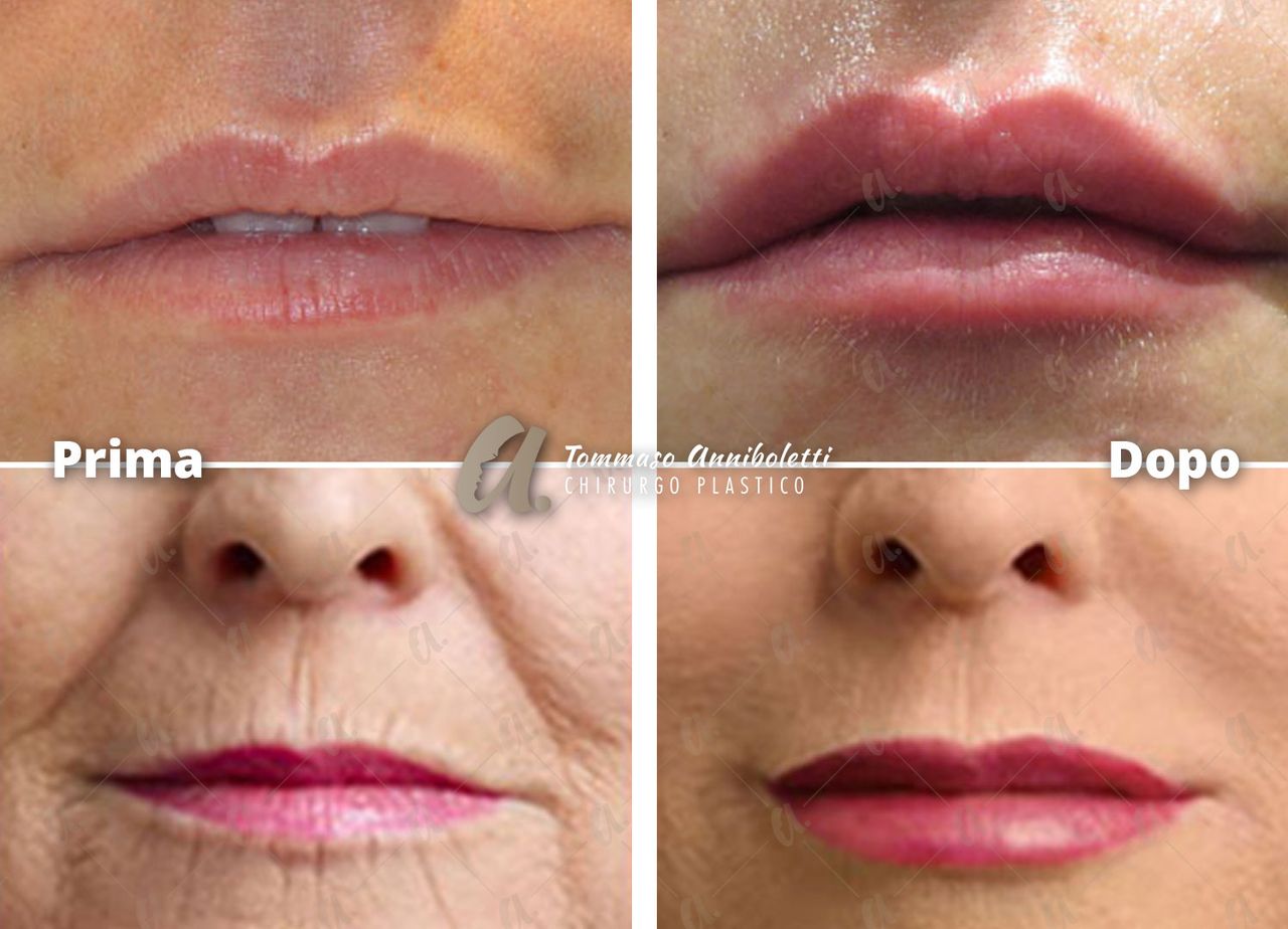 Tommaso Anniboletti-44