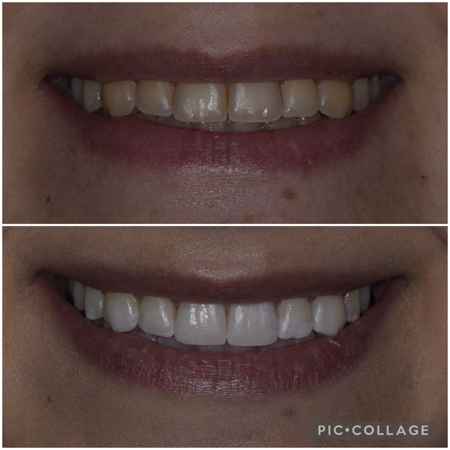 Saverio Giugliano-15