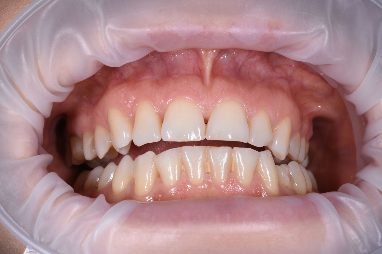 Patrycja Szczerbowska-2