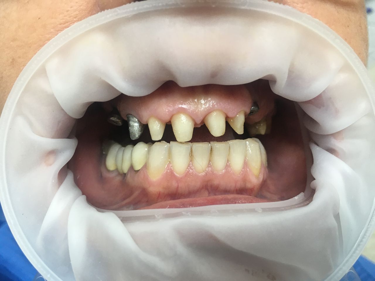 Luigi Aiardo Esposito-3