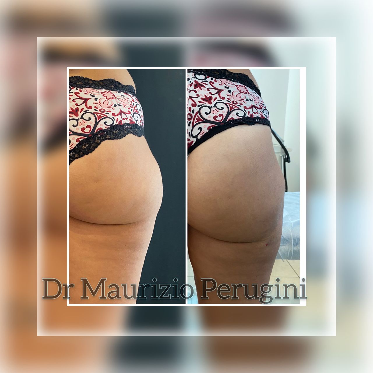 Maurizio Perugini-18