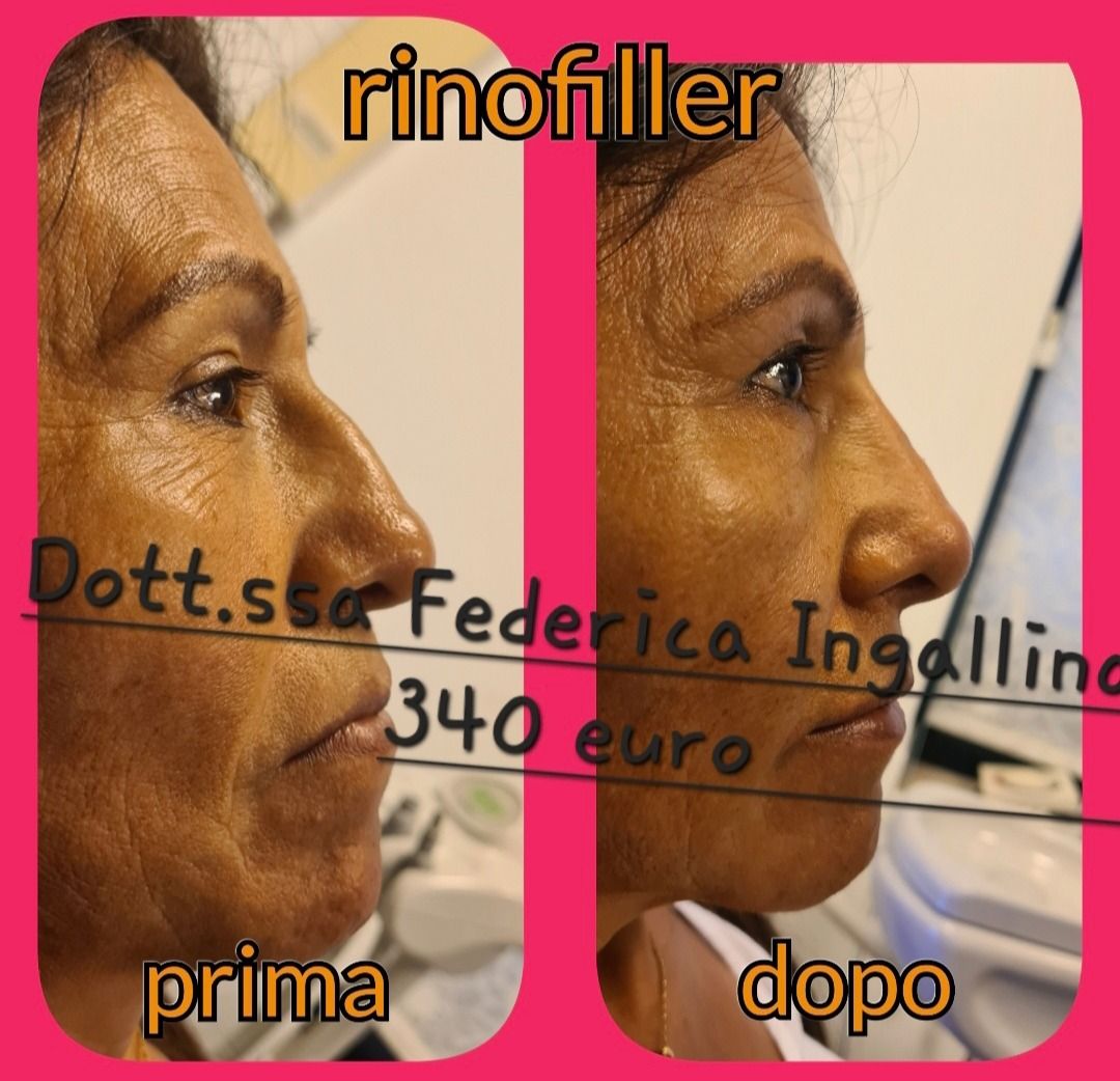 Federica Ingallina-30