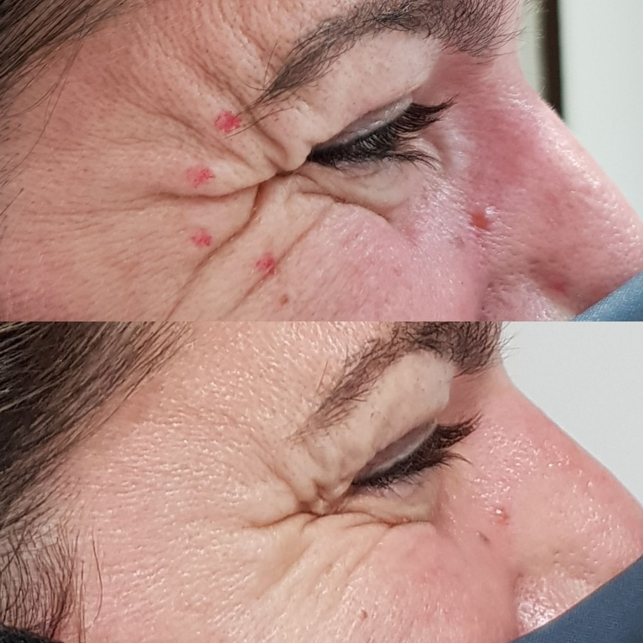 Rosalba Herrero Zerpa-306