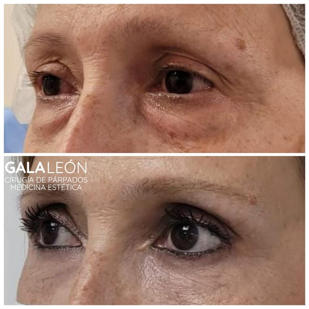 Gala P. Leon Salvatierra-16