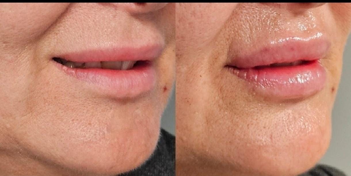 Rosalba Herrero Zerpa-576