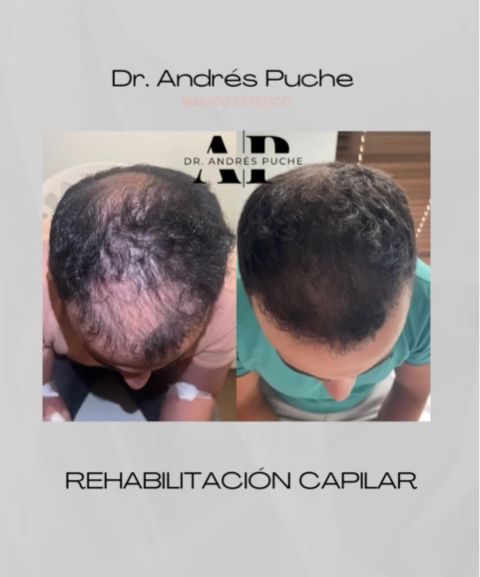 Andrés Puche Urdaneta-2