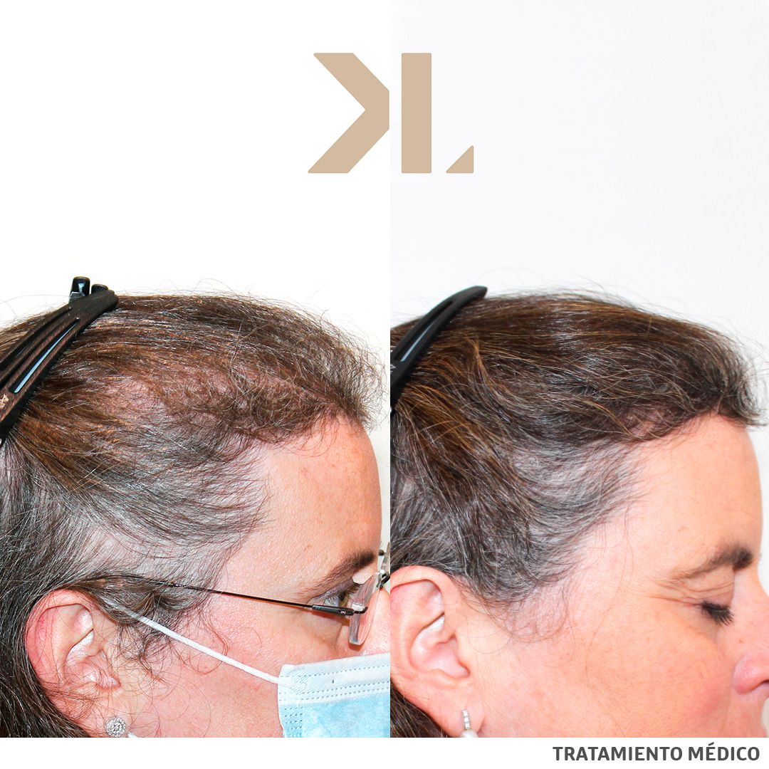 Karlexis León Montilla-4