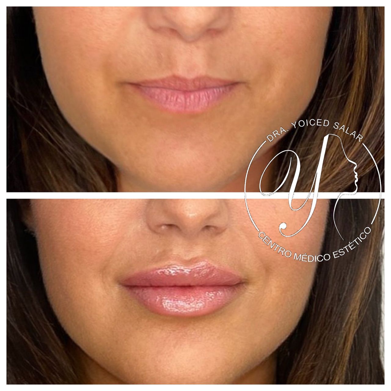 Yoiced Salar Peñate-15