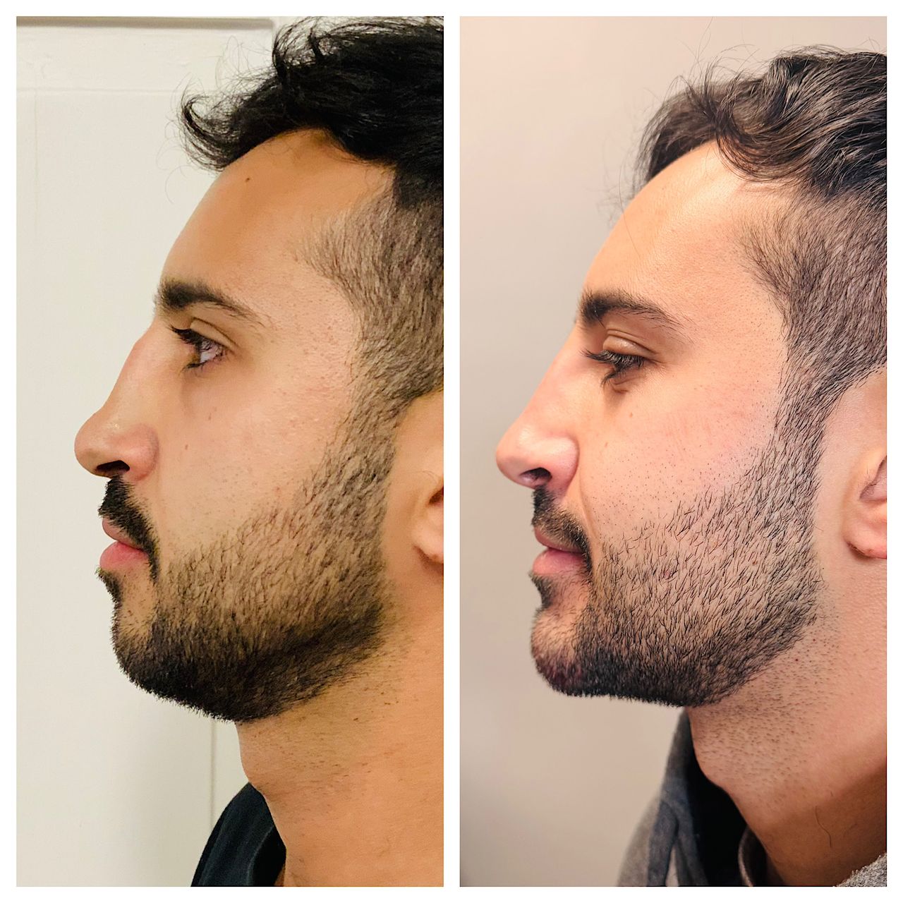 Anna Lucia Pignoli-1