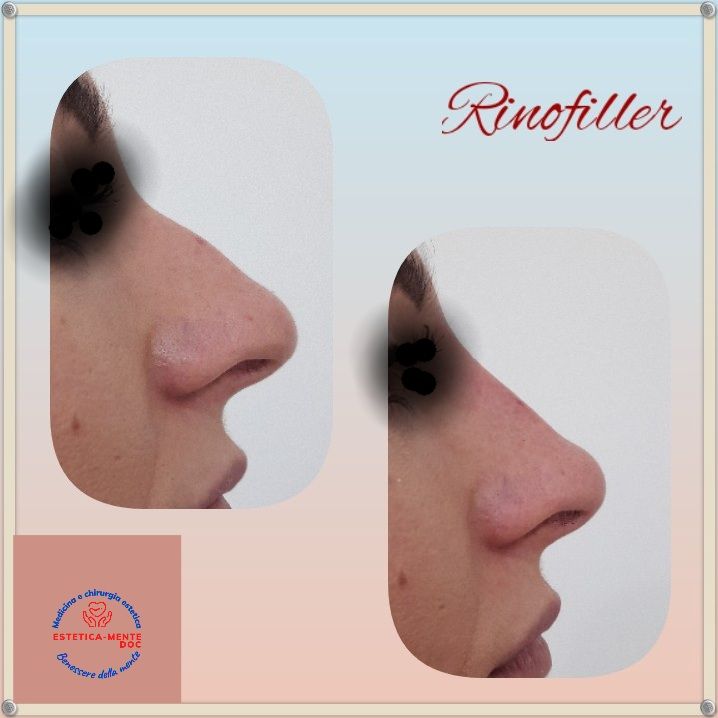 Paola Della Rocca-59