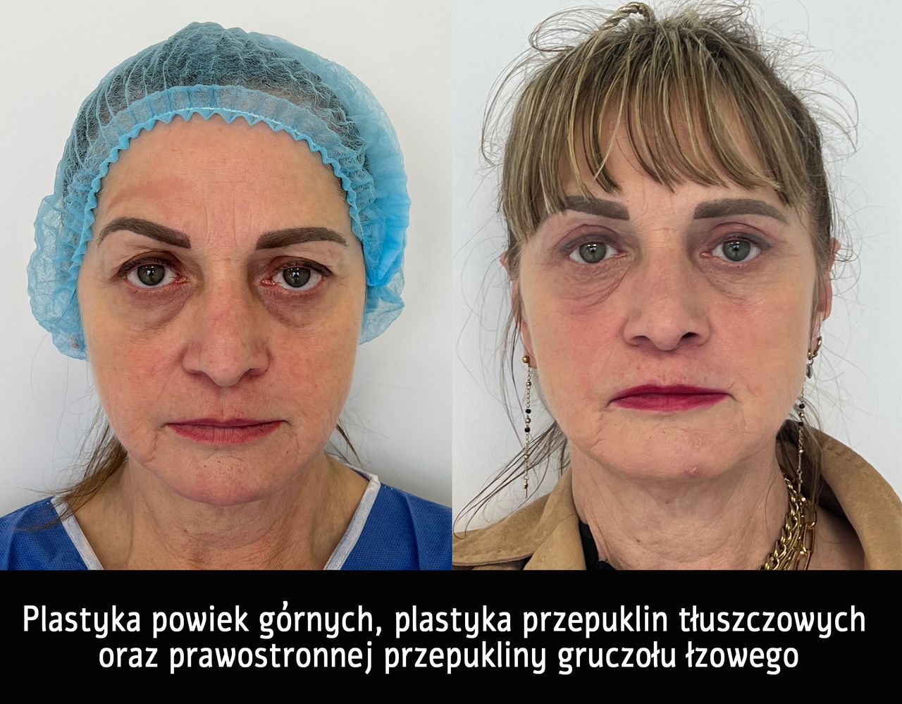 Mariusz Zagajewski-29