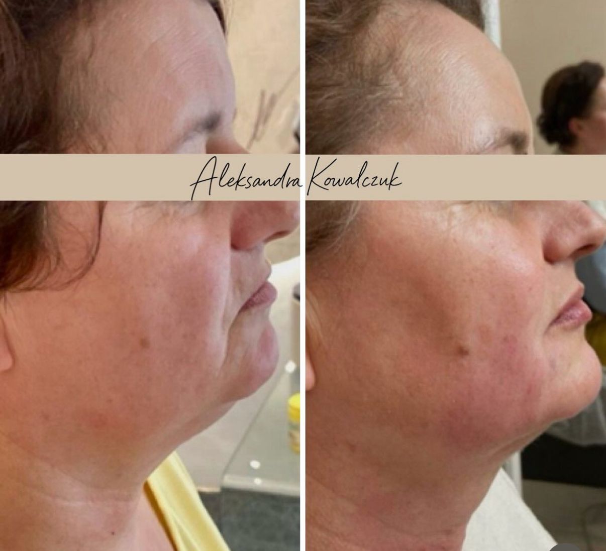 Aleksandra Kowalczuk-25