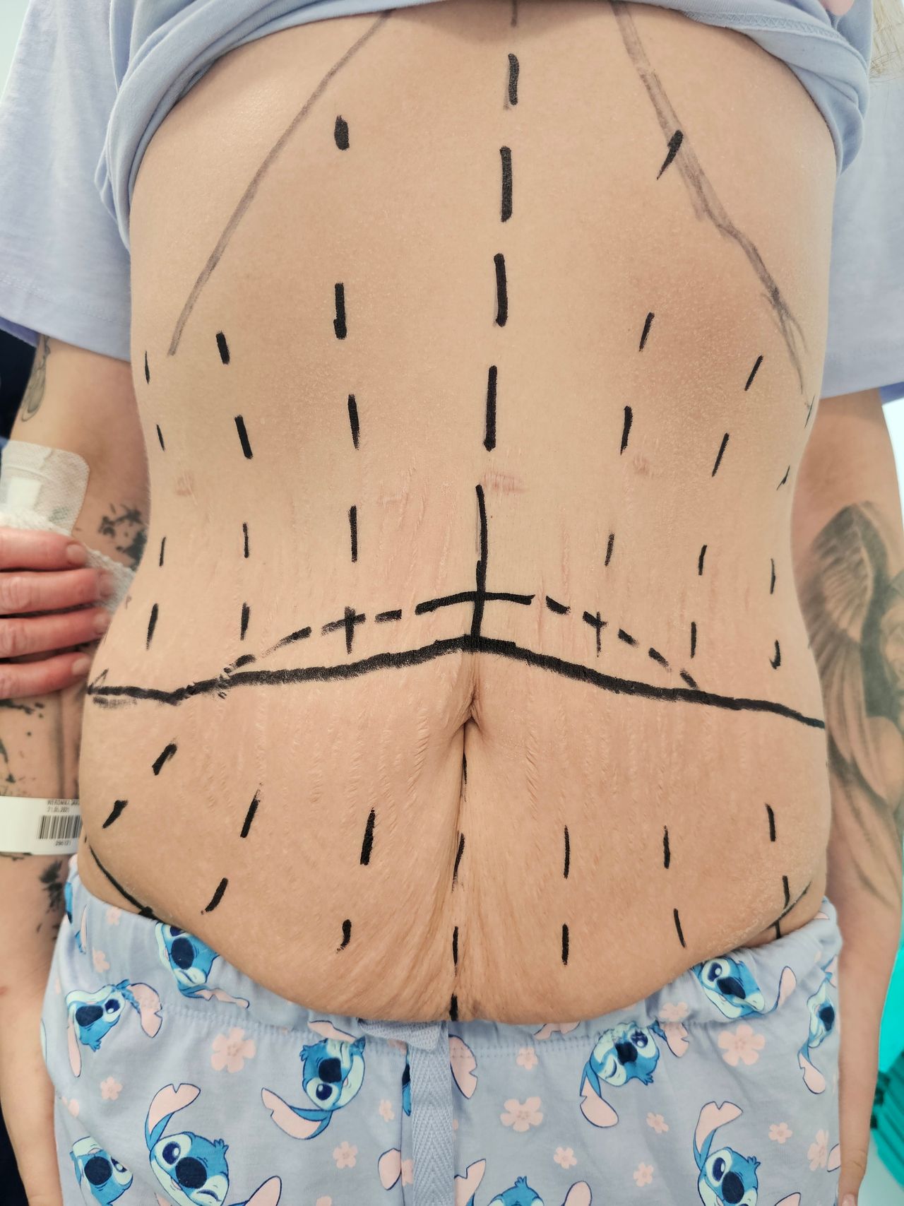 Bartłomiej  Staśkiewicz -4