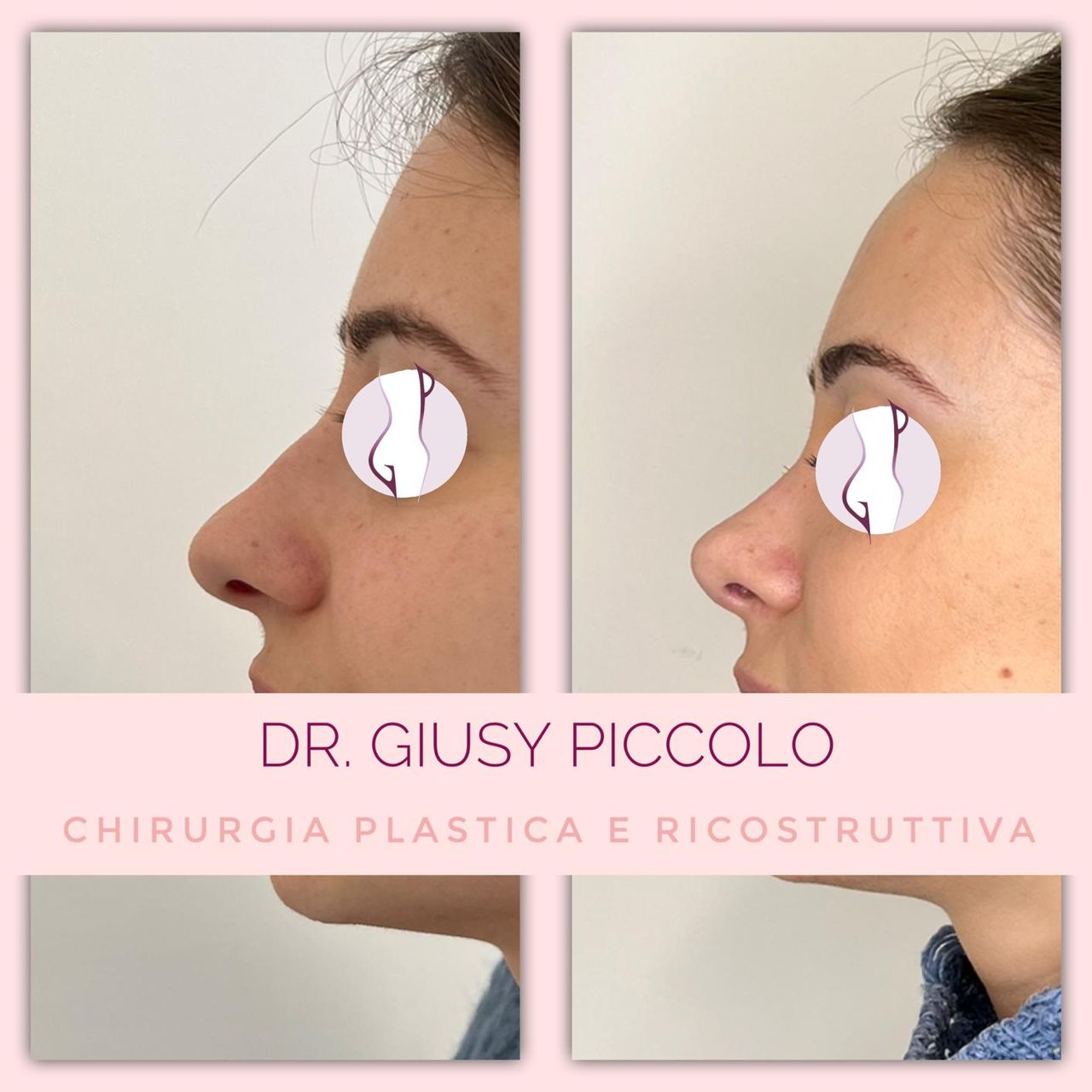 Giuseppina Piccolo-6