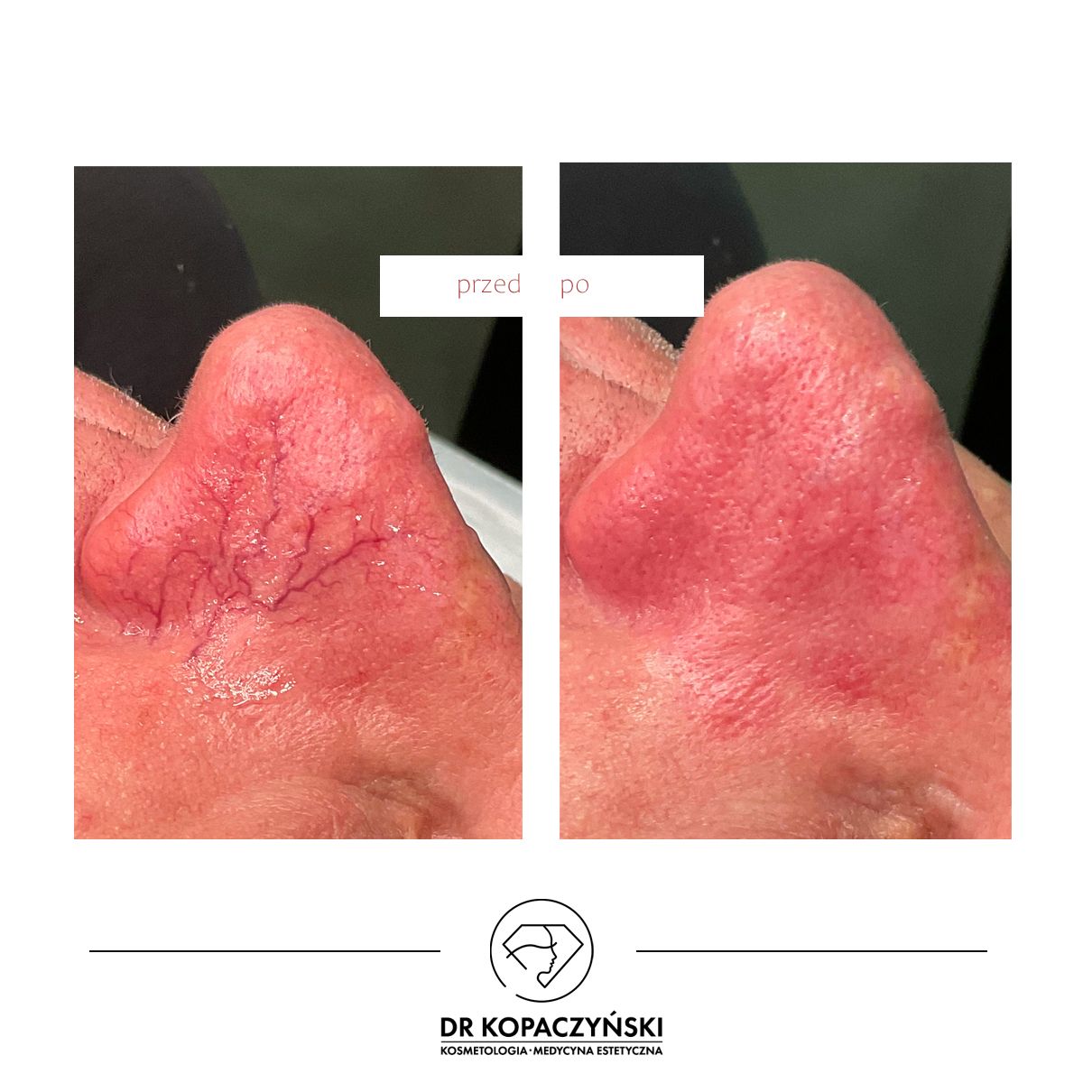 Jakub Kopaczyński-5