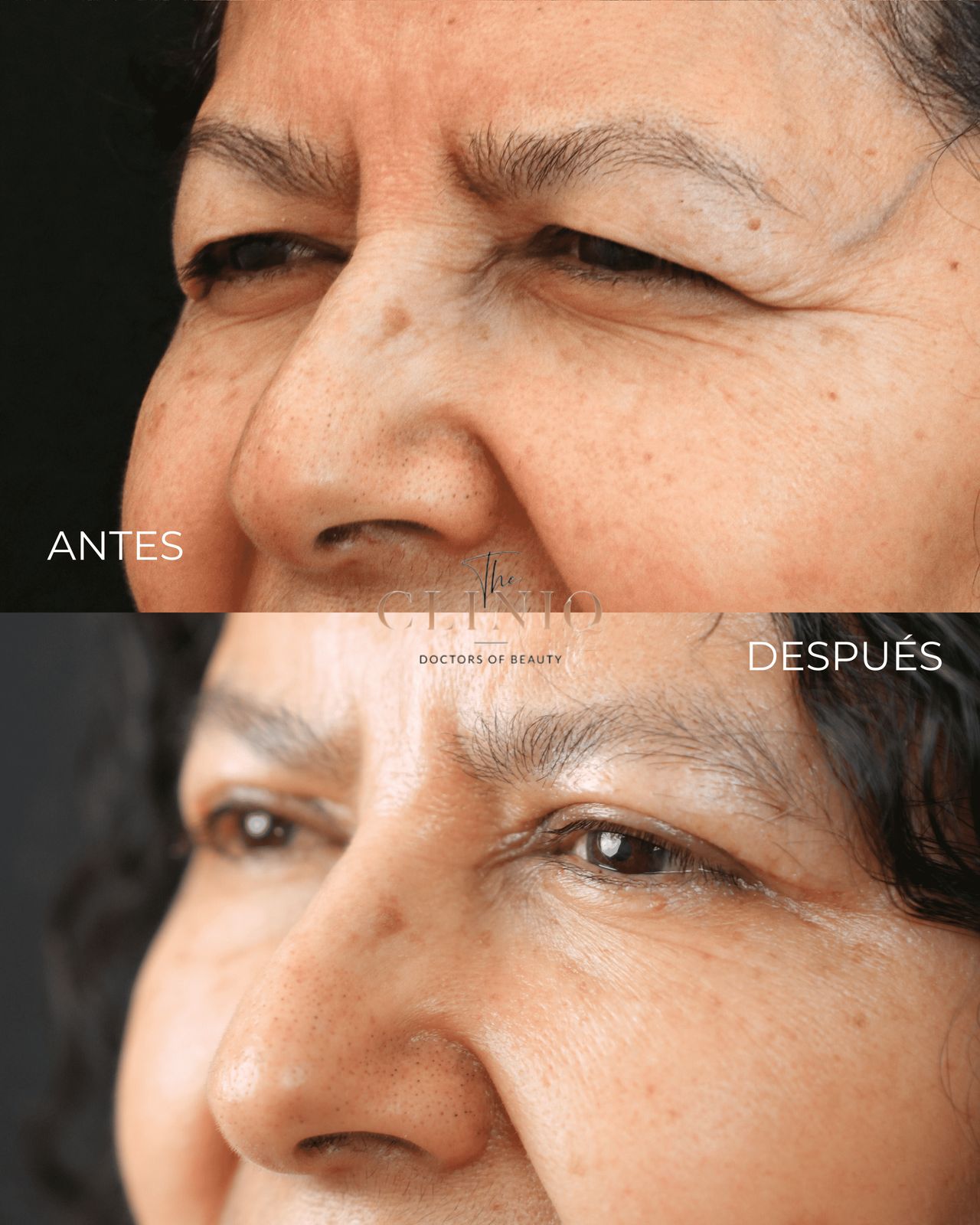 Ignacio Genol Saavedra-6