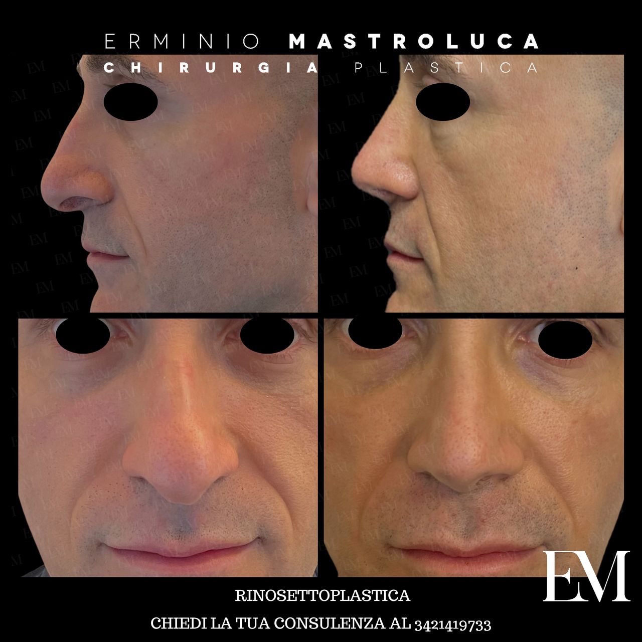 Erminio Mastroluca-15