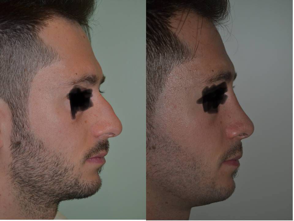 Pasquale Virciglio-30