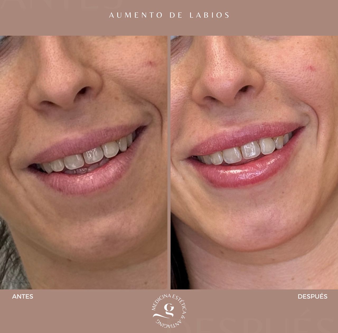 ​Giovanni Giorgianni-44