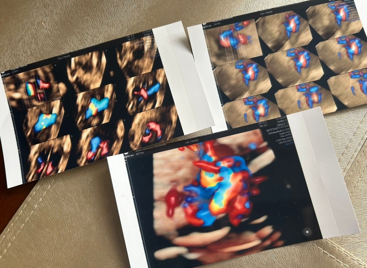 Wioletta Rozmus-Warcholińska-139