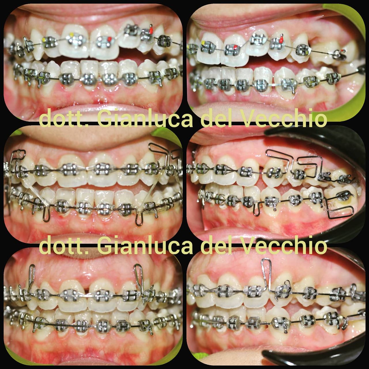 Gianluca Del Vecchio-29