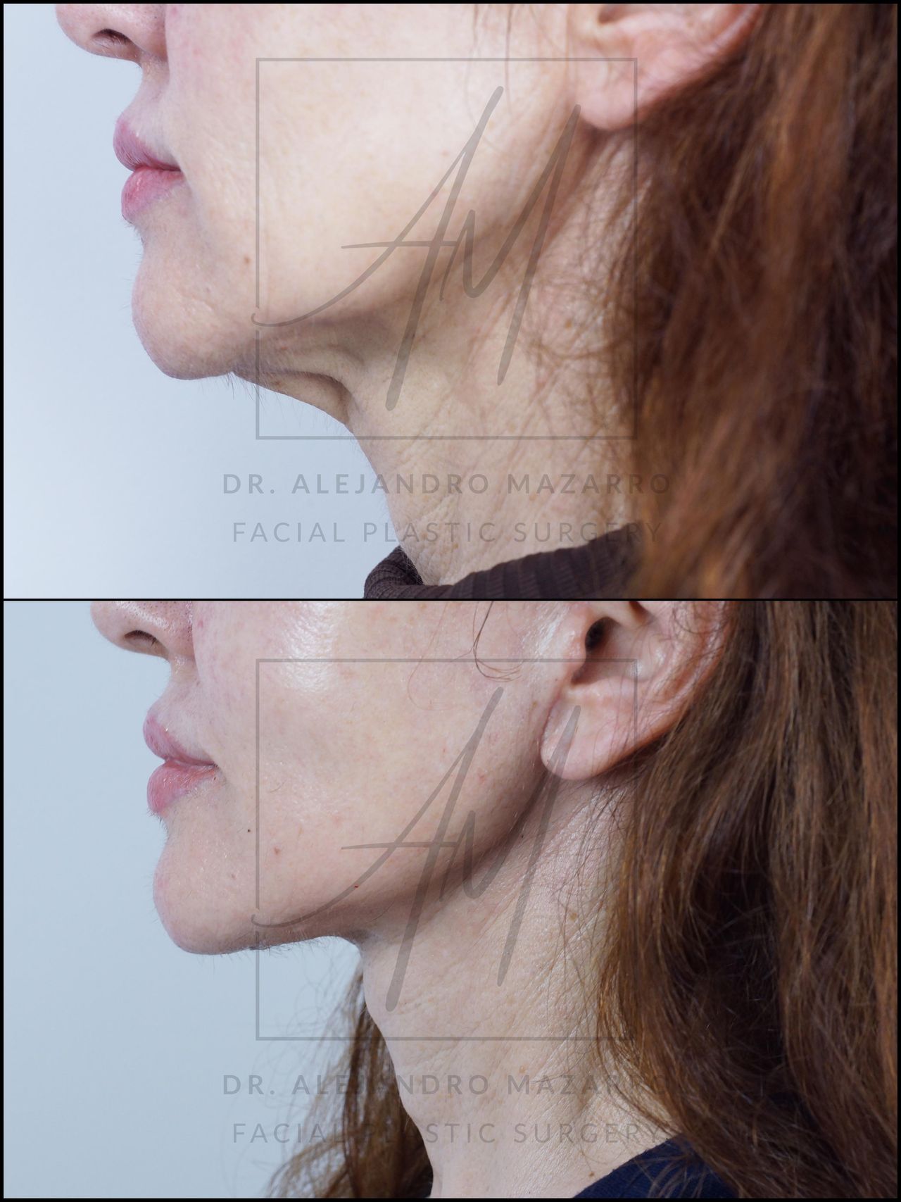 Alejandro Mazarro Campos-5