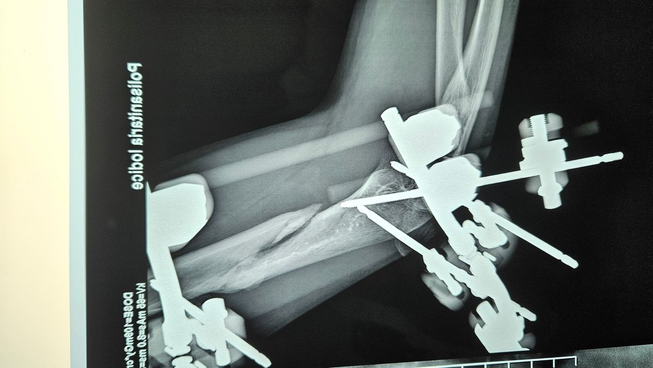 Gennaro Campopiano-11