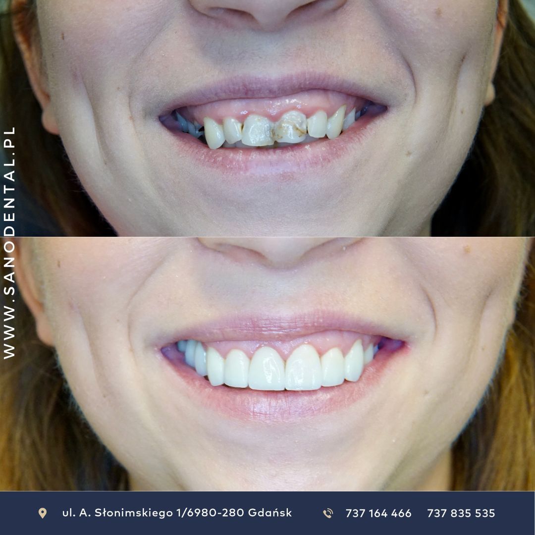 Grzegorz Wójcicki-0