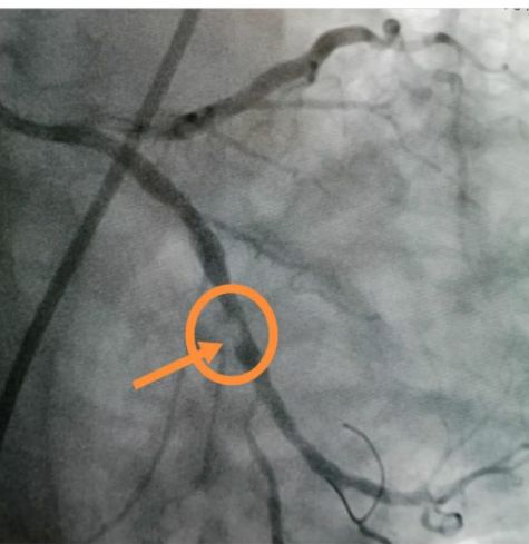 Hüseyin Onur Şahin-18