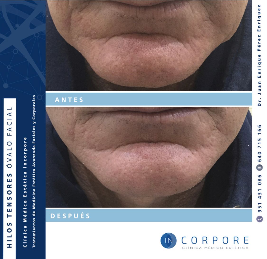 Juan Enrique Pérez Enríquez-83