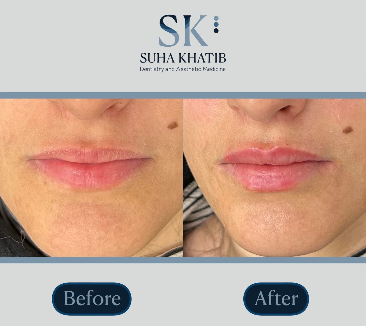 Suha Khatib-15