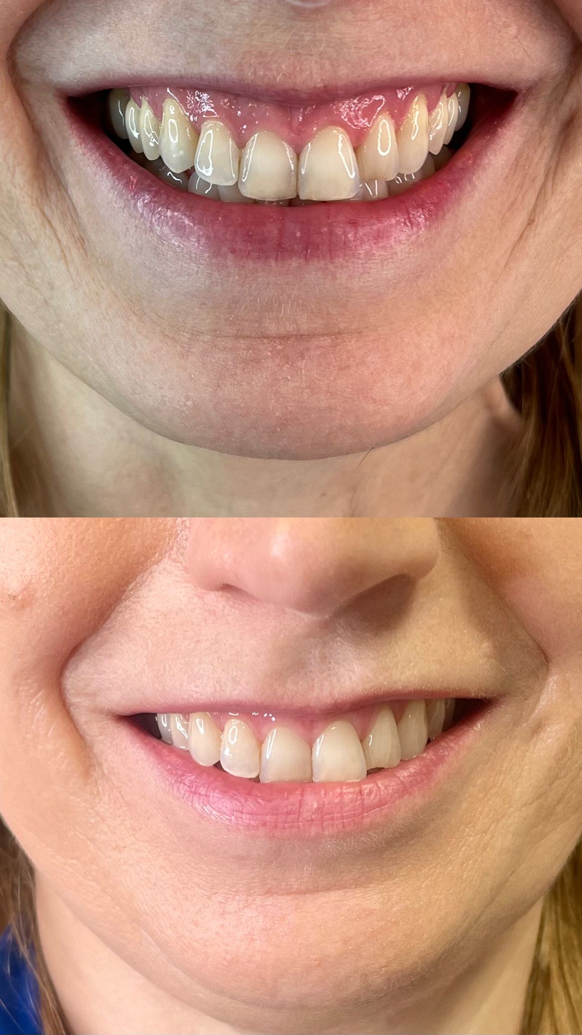 Adrianna Kostrzewa-13