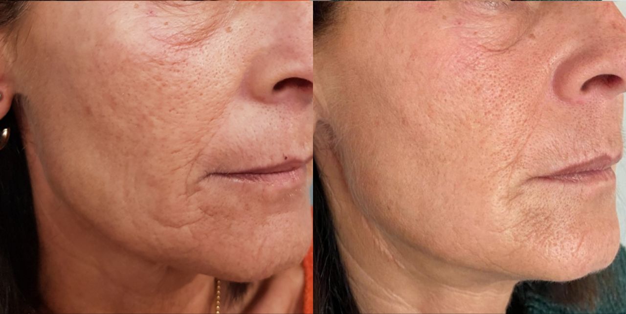 Rosalba Herrero Zerpa-51