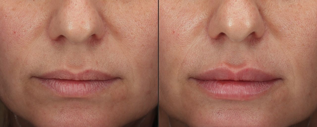 Giordano Vespasiani-27