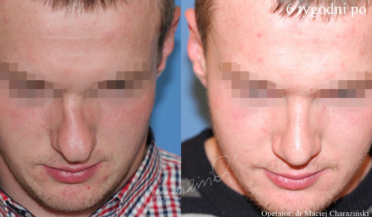 Maciej Charaziński-50